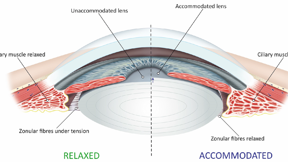IMI Accommodation and Binocular Vision in Myopia Development and Progression